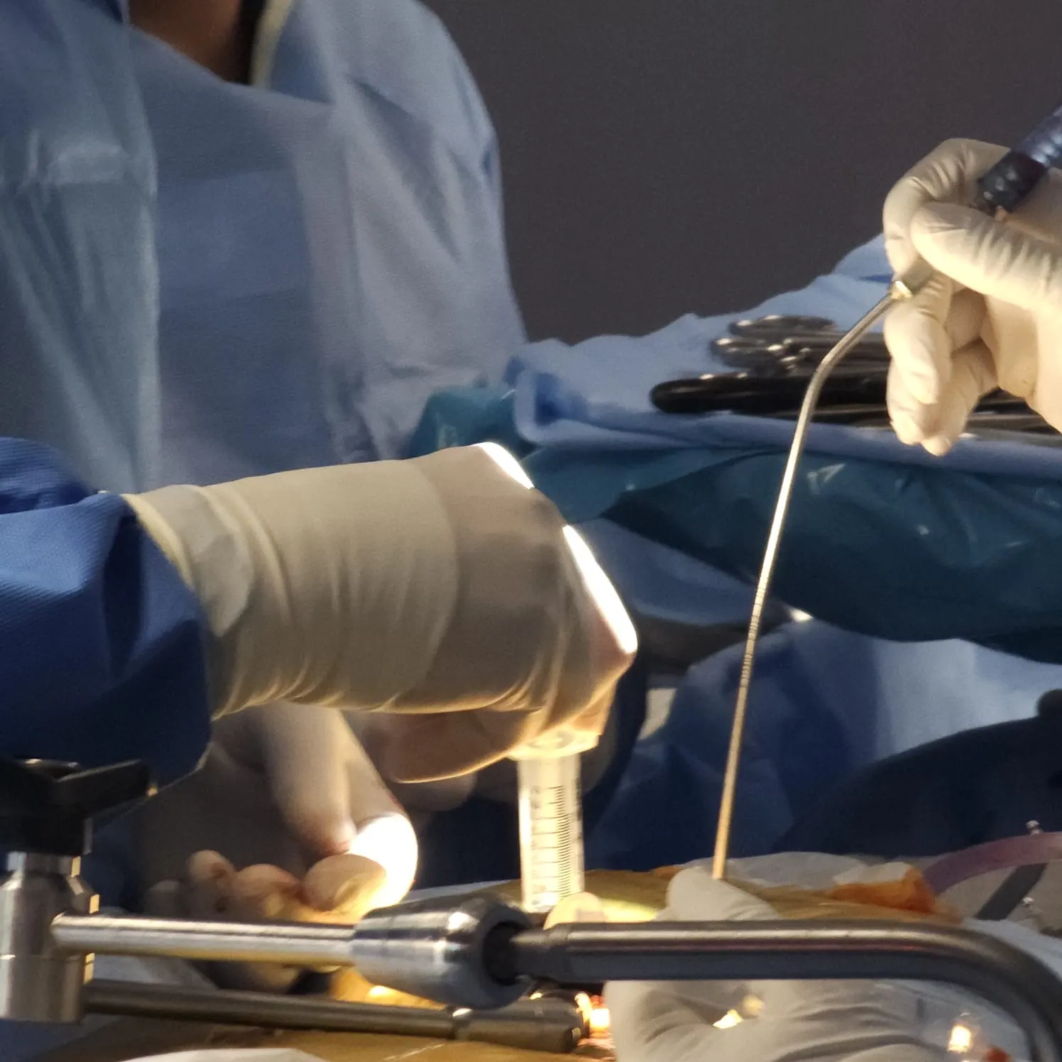 Close-up of the technique during spine surgery
